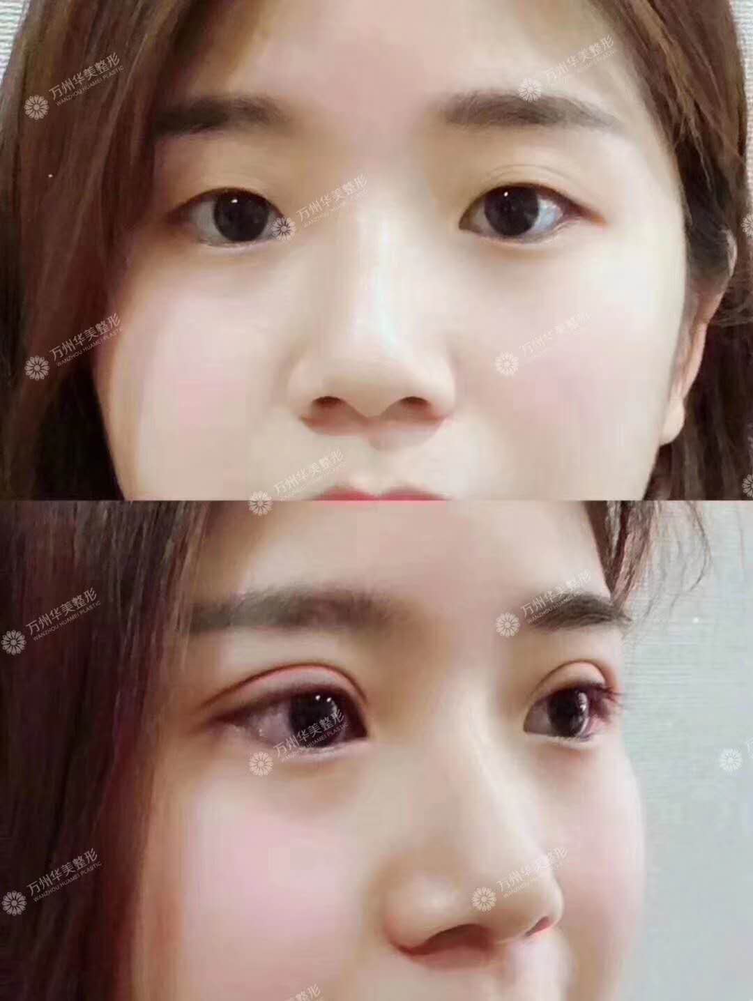 11.webp.jpg